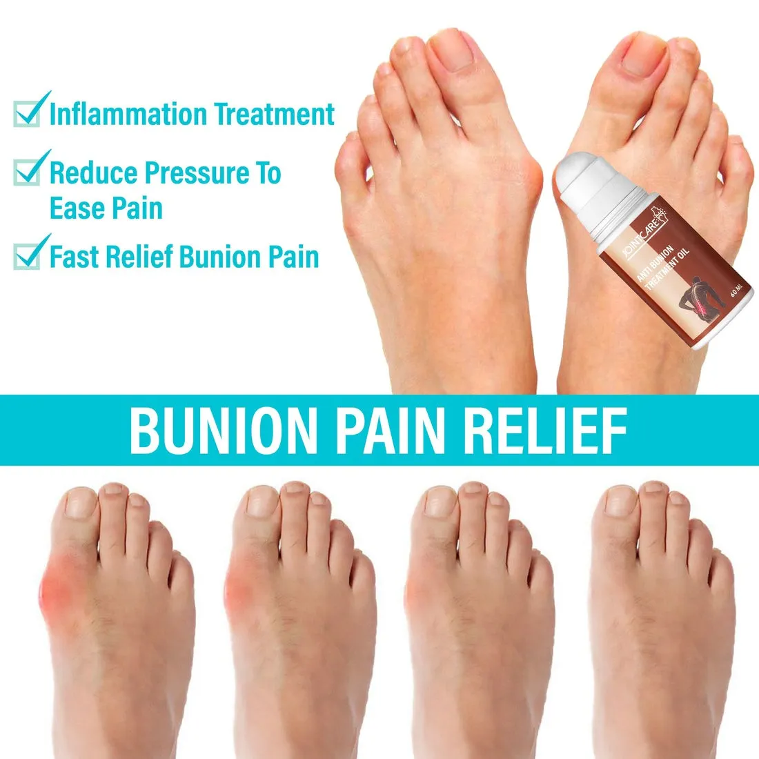 JointCare Anti Bunion Treatment Oil