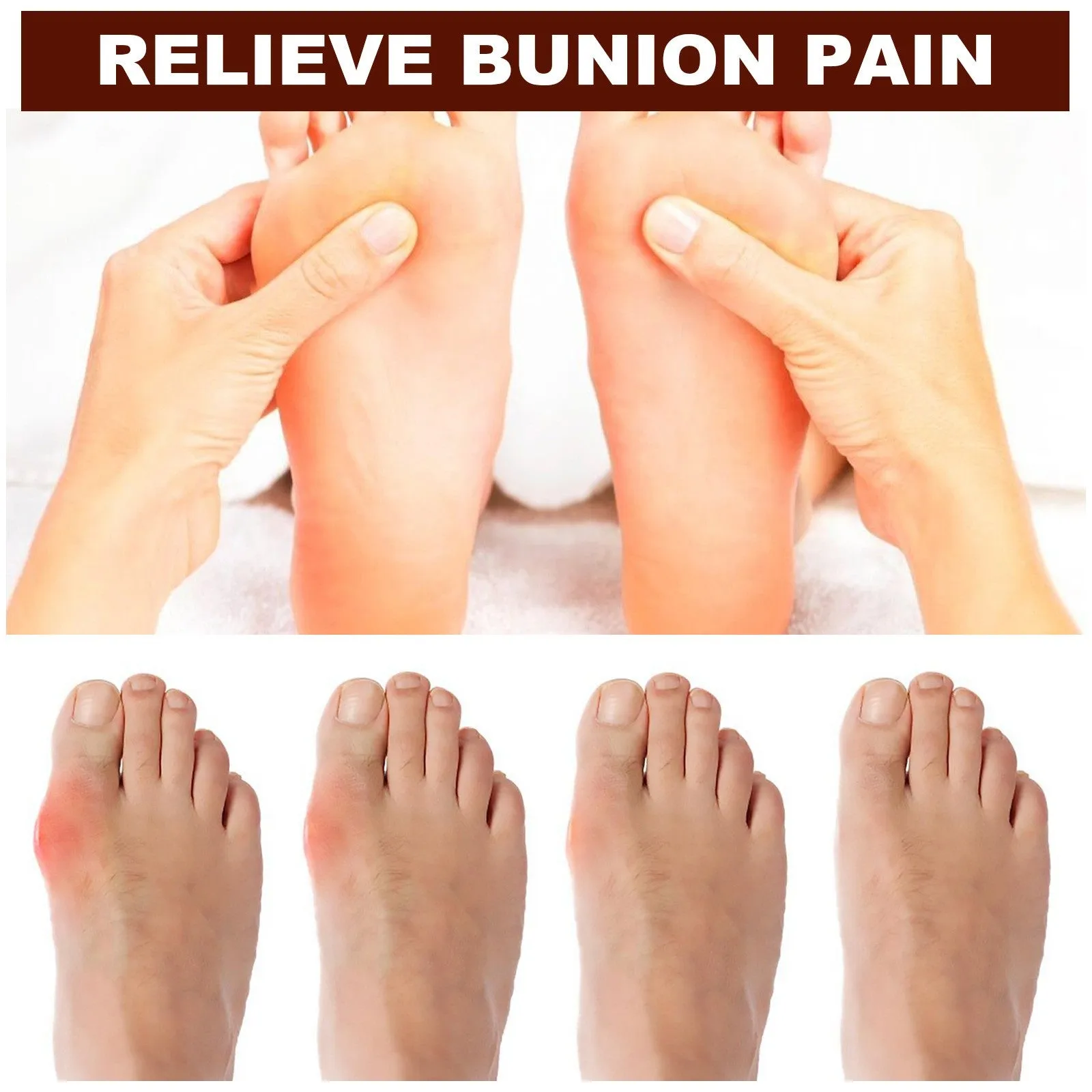 JointCare Anti Bunion Treatment Oil